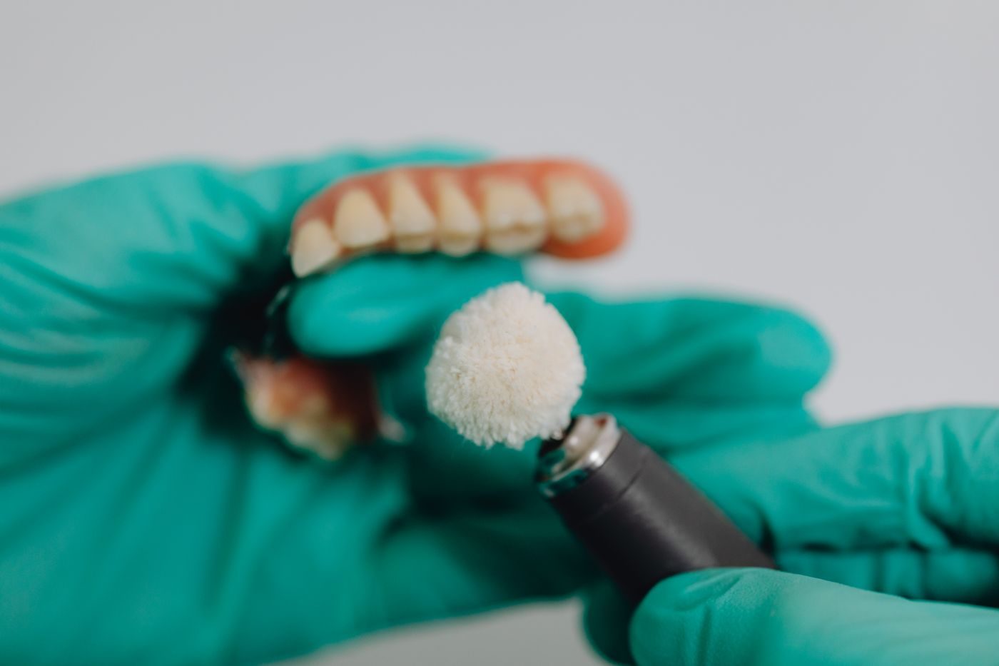 전악 임플란트 고정형 보철 — ID Dental 코리아타운 풀마우스 복원